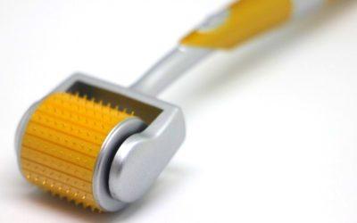 The Benefits of Microneedling