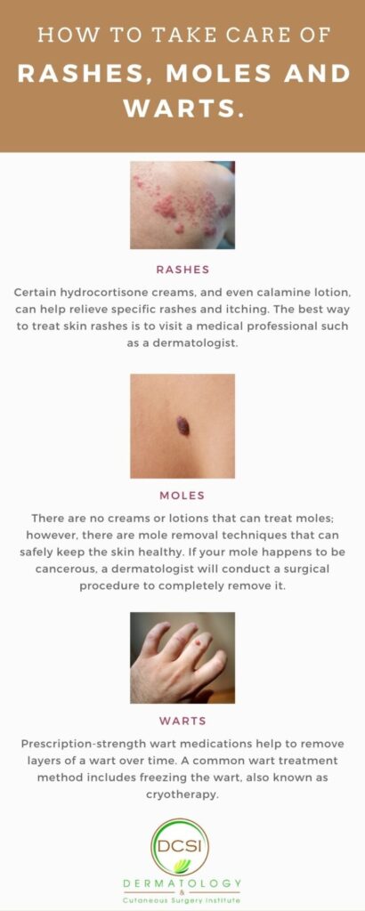 infographic on how to take care of rashes, moles and warts 