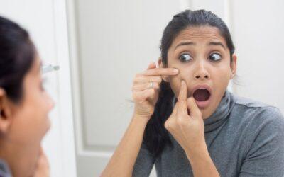 How to Remove Blackheads Properly