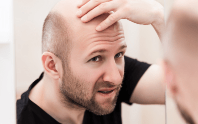 Understanding the Baldness Gene: Is Hair Loss Really In Your DNA?