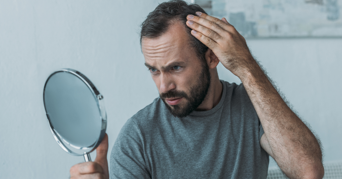 Male Hair Loss Facts - MyDCSI