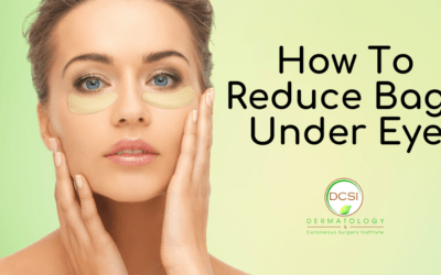 How To Reduce Bags Under Eye