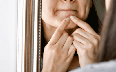 Skin Picking Disorder