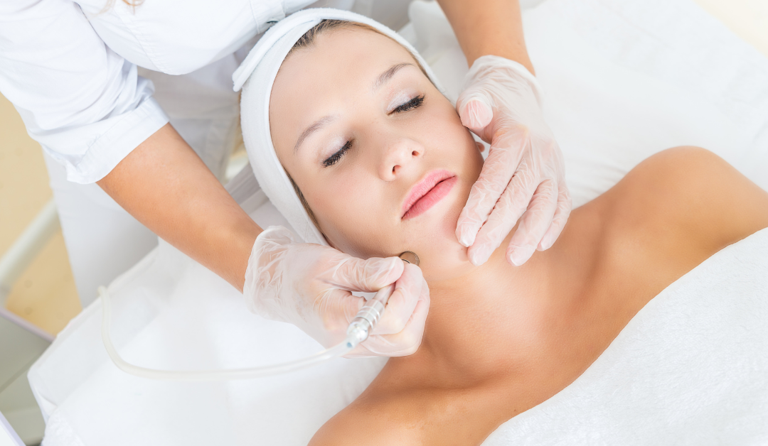 What Can a Dermatologist Do for Acne Scars?