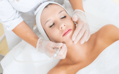 What Can a Dermatologist Do for Acne Scars?