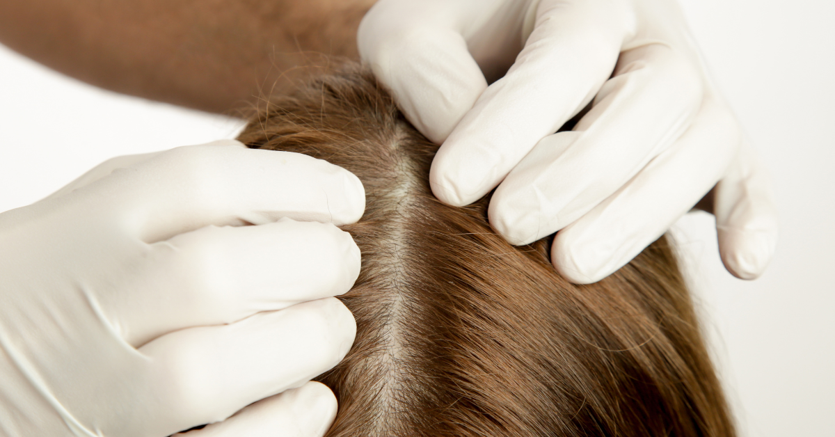 What are the Best Healthy Scalp Tips? | MyDCSI
