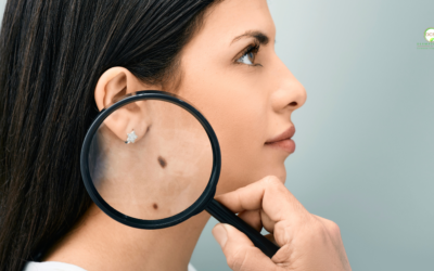 How to Avoid Skin Cancer: Summer Protection Tips From South Florida Dermatologists