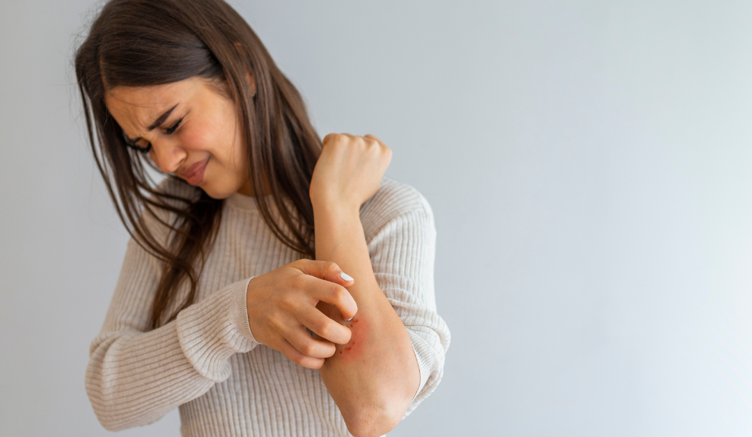 Should You Exfoliate Eczema? Navigating Skincare With Sensitivity
