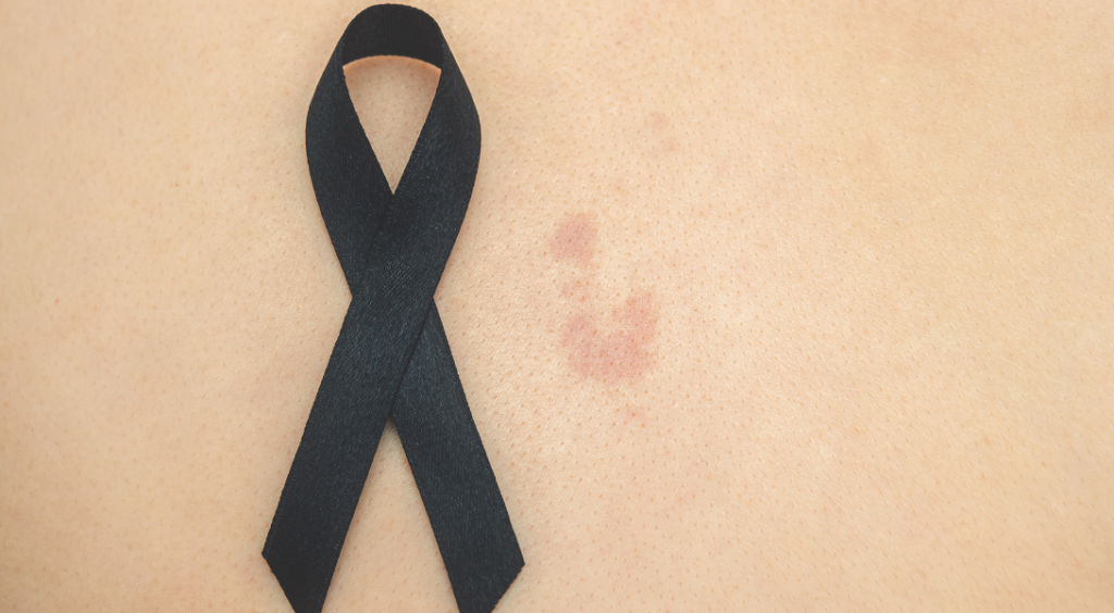 black ribbon for skin cancer awareness month