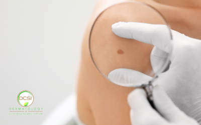 Mohs Surgery Questions Answered