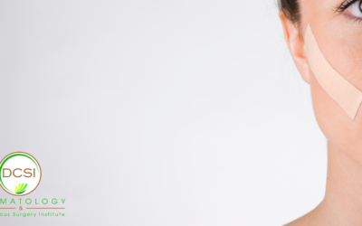 Tips for Healing After Mohs Surgery