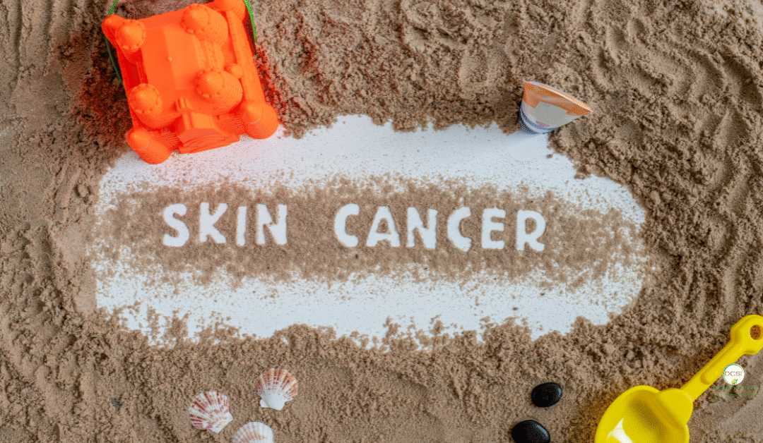 Types of Skin Cancer: Can They Kill?