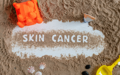 Types of Skin Cancer: Can They Kill?