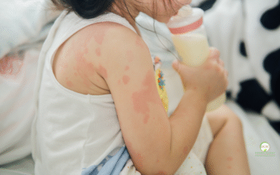 Understanding Pediatric Skin Conditions: A Guide for Parents in South Florida
