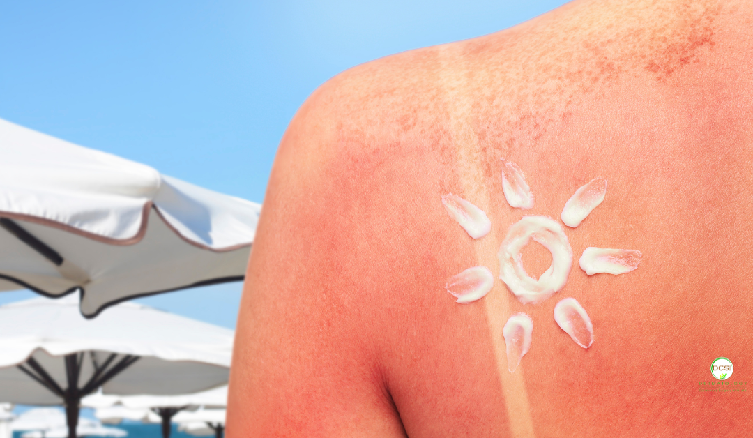 How to Spot the Early Signs of Sun-Damaged Skin