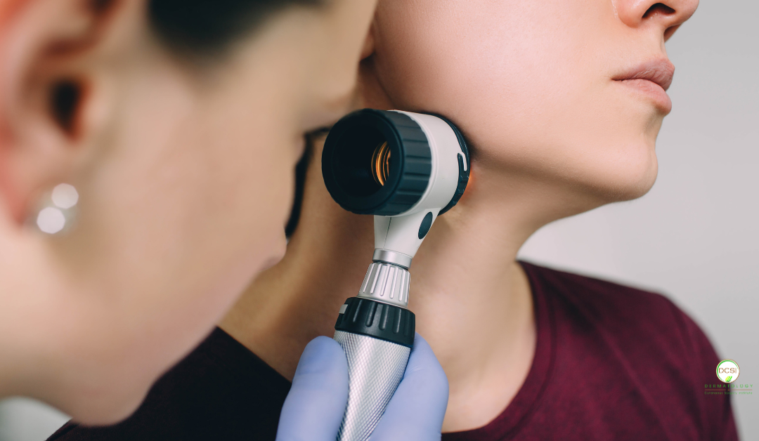 What to Expect During Your First Full-Body Skin Exam at DCSI
