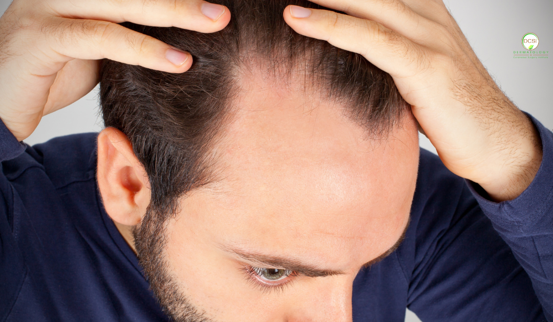 Understanding Male Receding Hairline: Causes, Signs, and Proven Treatments