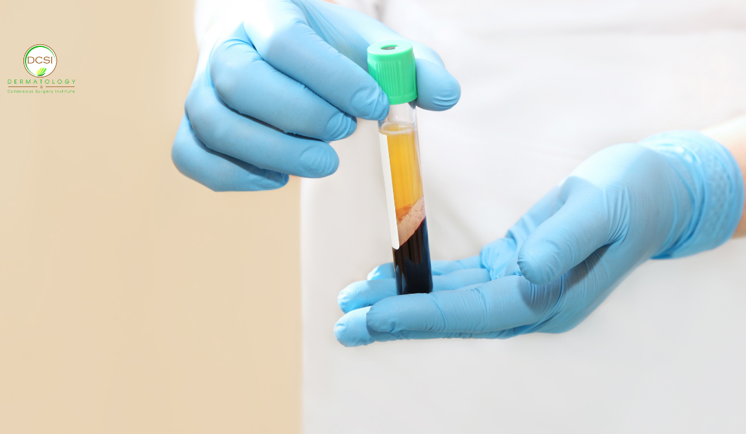 Exosomes vs. PRP: Which Regenerative Treatment Is Right for You?